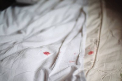 5 Cara Menghilangkan Noda Darah Haid di Kasur